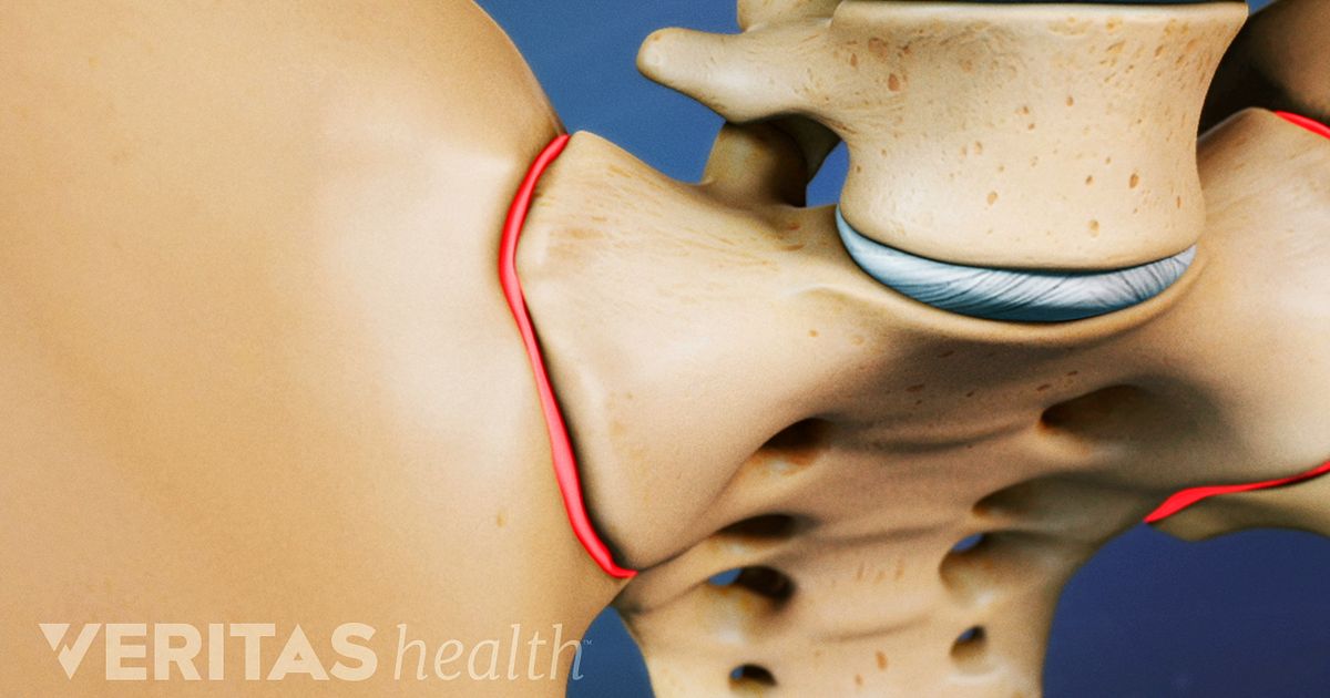 Neck Sprain Injury Symptoms and Treatments photo Neck Sprain Injury Symptoms and Treatments images