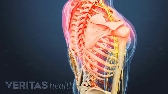 What are some treatment options for chronic thoracic spine pain?