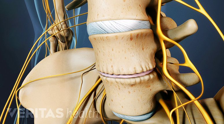 what-is-degenerative-disc-disease