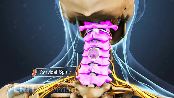 Chronic Neck Pain: What Condition is Causing My Neck Pain?