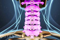 Getting the Right Diagnosis for Numb Fingers