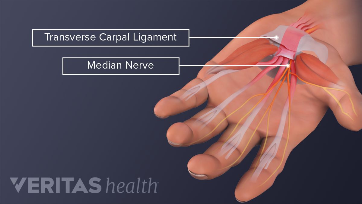 is-my-hand-pain-from-carpal-tunnel-syndrome-or-something-else