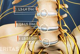All about L5-S1 (Lumbosacral Joint)