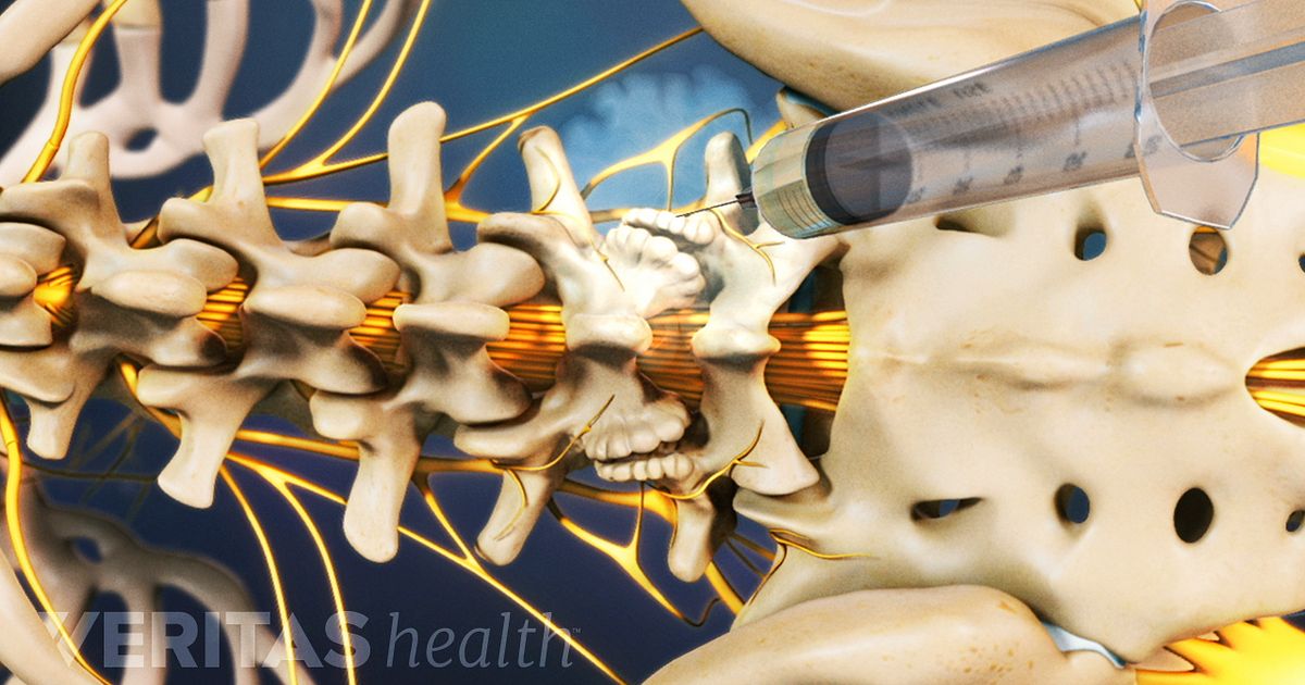 calaptin 240 sr side effects