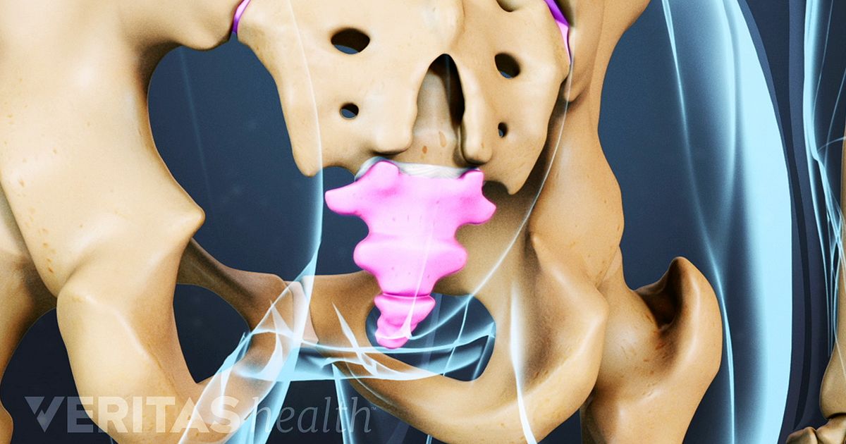 Duele el tórax y la espalda al embarazo