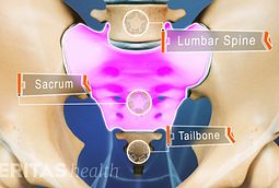 Spinal Abnormalities Rarely Cause Back Problems