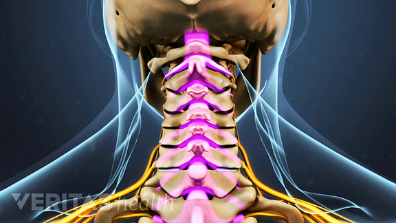 When should you seek professional help for stiff neck pain?