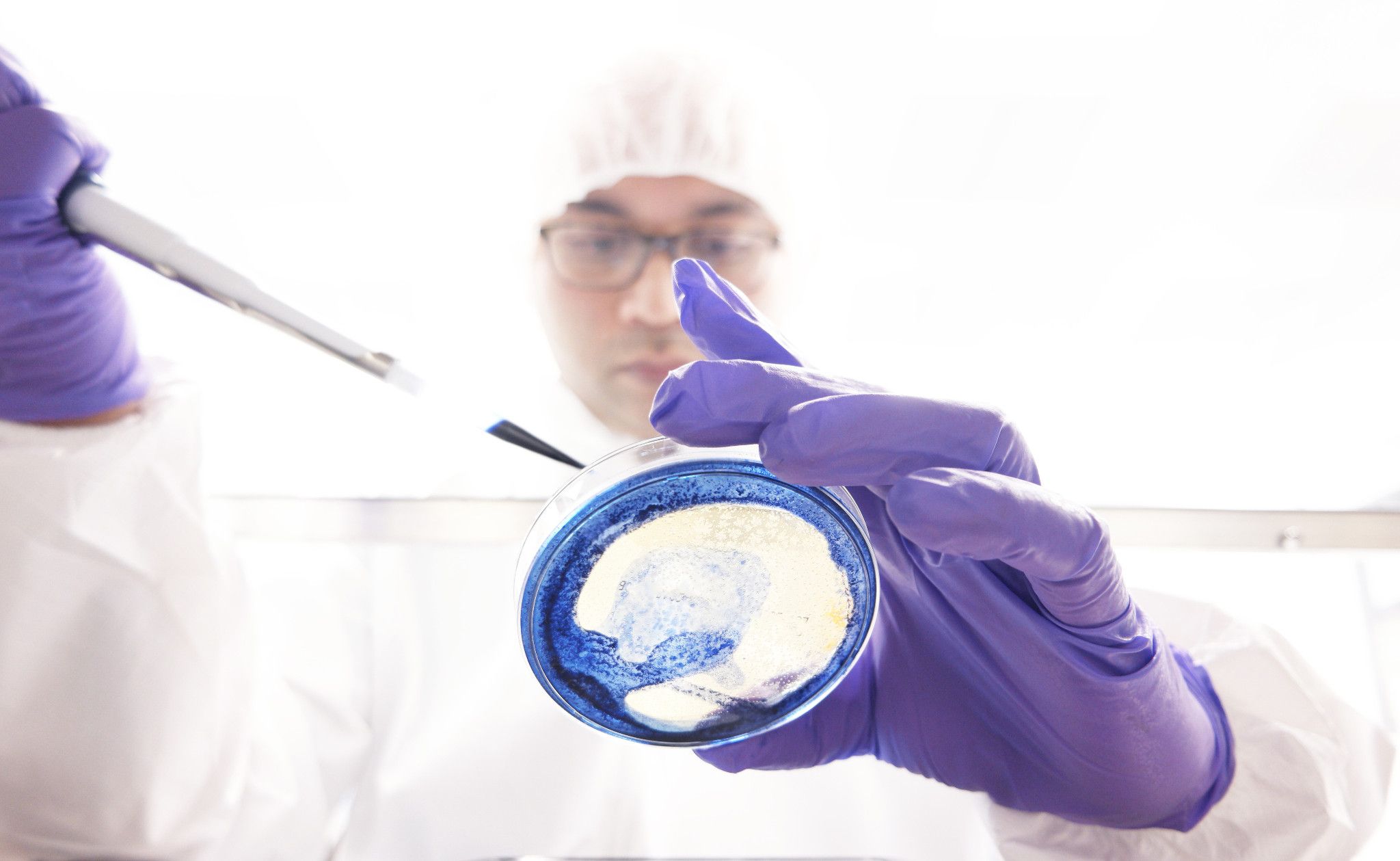 lab technician with petri dish