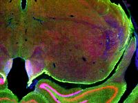 Psychoplastogens: The Evolution of the Psychedelic Revolution image