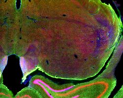 Fluorescence view of rat brain slice used in Alzheimer's Disease Research Studies.