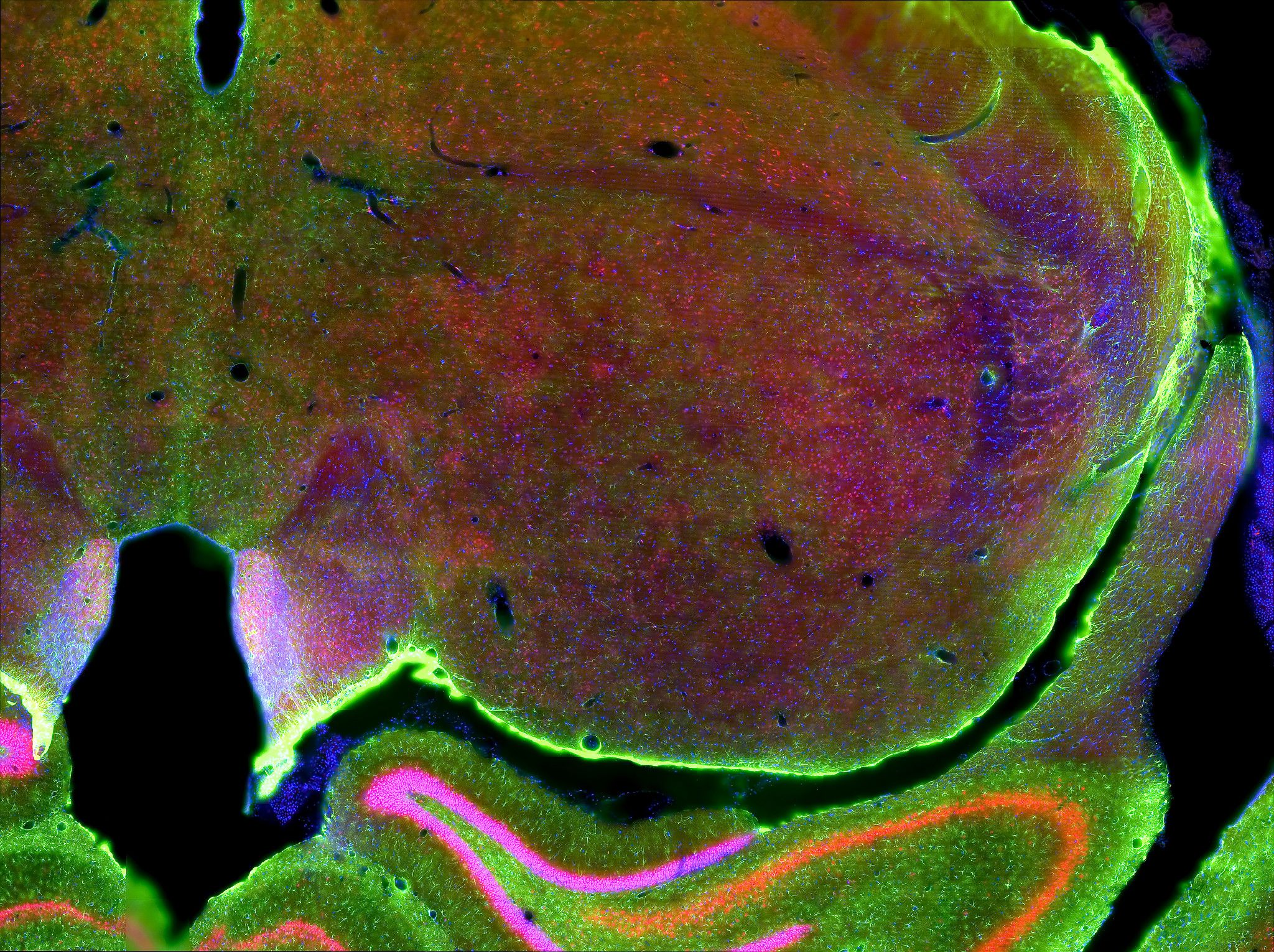 Fluorescence view of rat brain slice used in Alzheimer's Disease Research Studies.