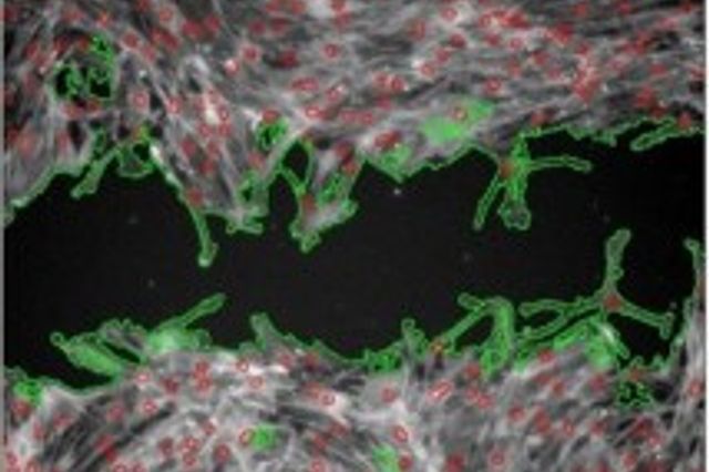 image of migration scratch assay