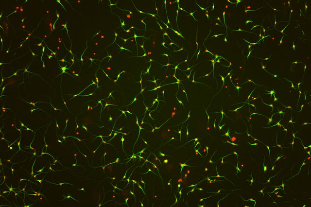 iPSC-derived neurons stained with MAP2 and nuclear stain to identify neurite outgrowth.
