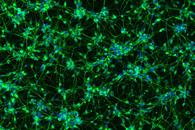 Immunostaining of iPSC derived neurons with BIII Tubulin and DAPI