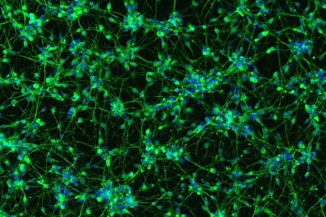 Immunostaining of iPSC derived neurons with BIII Tubulin and DAPI