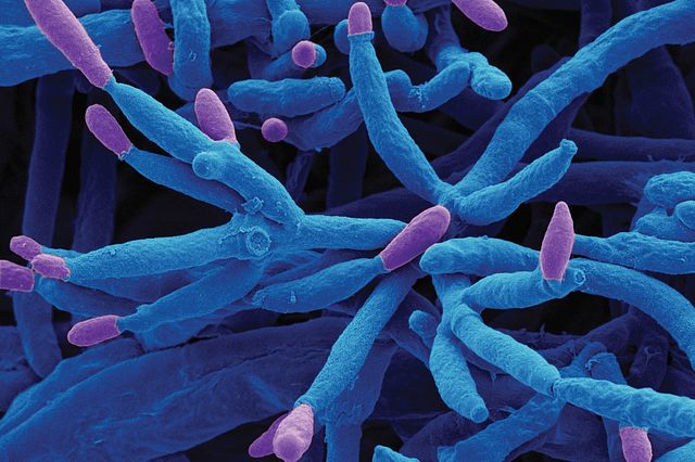 scanning electron microscopy image of a fungal organism