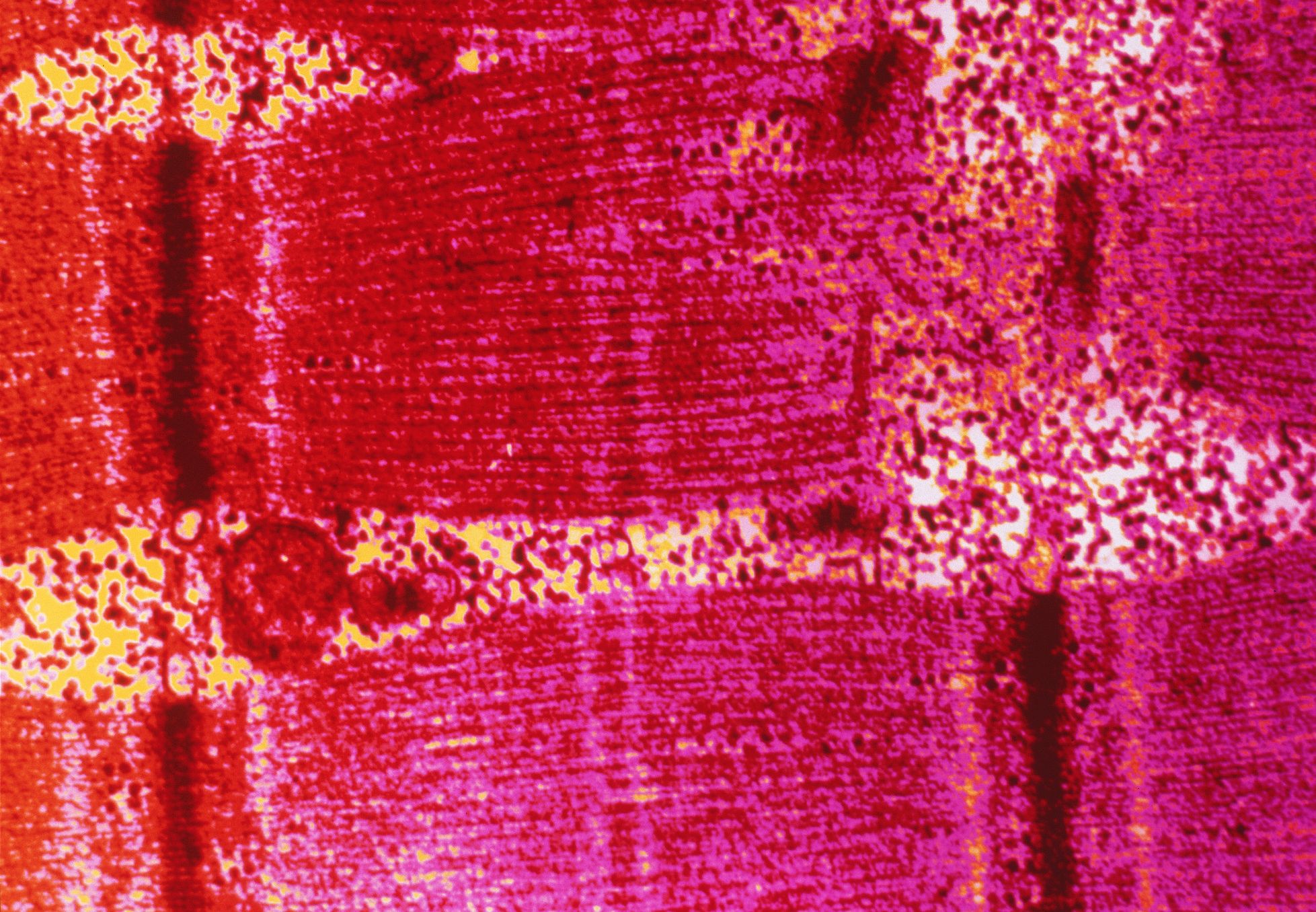 microscopic muscle