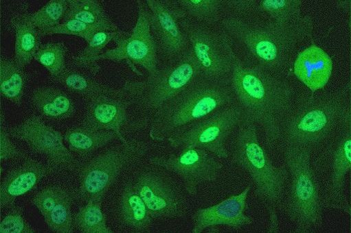 In vitro assays for tumor model selection in oncology research
