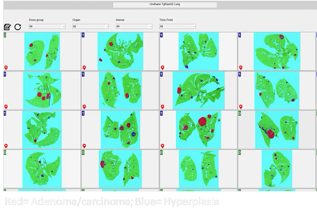 Digital Pathology slides with Patholytix