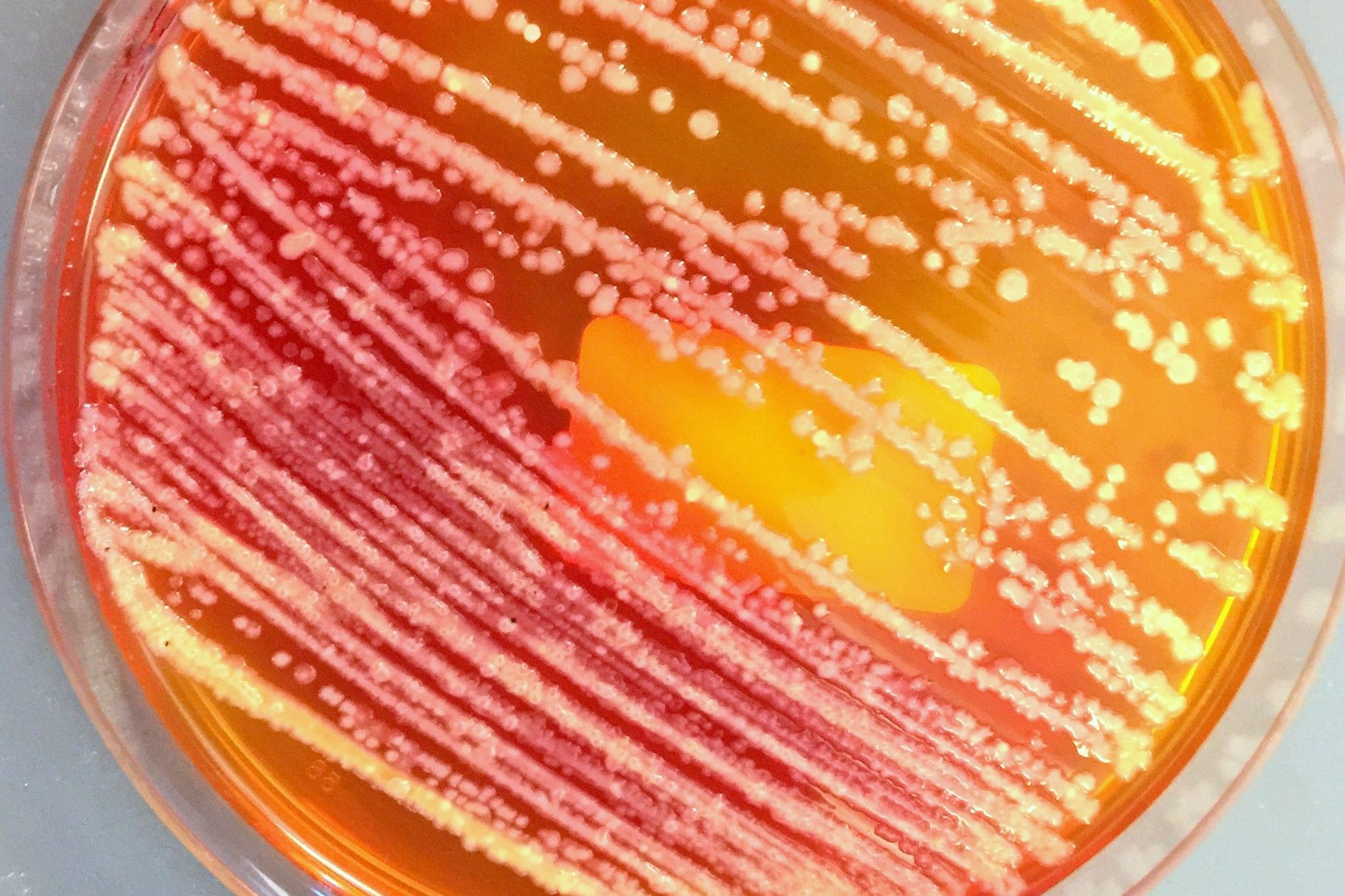 Enterobacteria grown on an agar plate