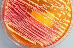enterobacteria grown on an agar plate