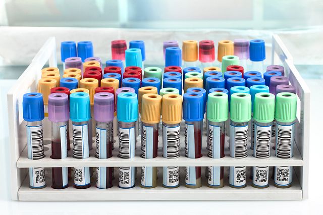 blood tube test in a tray for analysis in the laboratory of haematology.