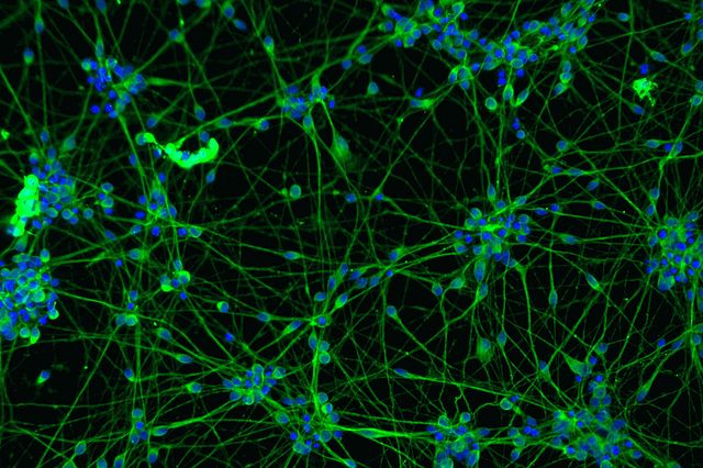 blue and green microscopic image of neural stem cells