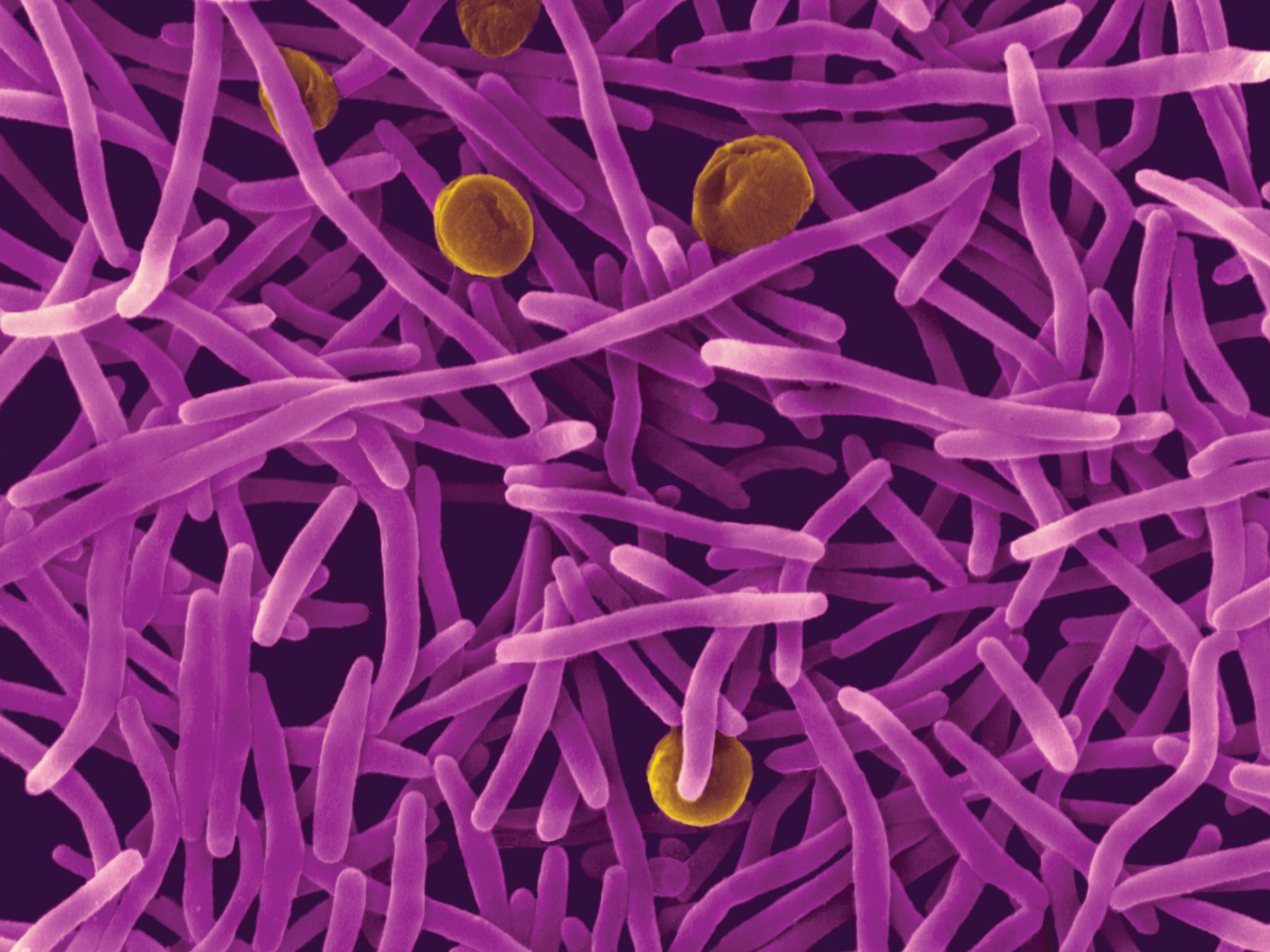 Microscopic image of bacteria cells.