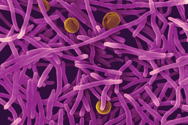 micro electron bacteria