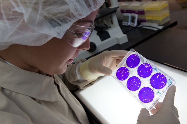 Lab technician observing plaque assay results