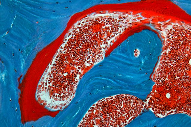 histology image of bone tissue