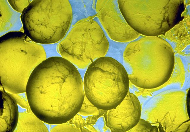 metabolic disease