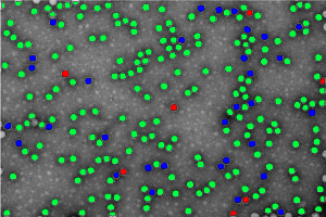 Learn more about our immuno-electron microscopy services to detect subcellular localization of test article and high-throughput quantification of full and empty AAV capsids for cell and gene therapy studies.