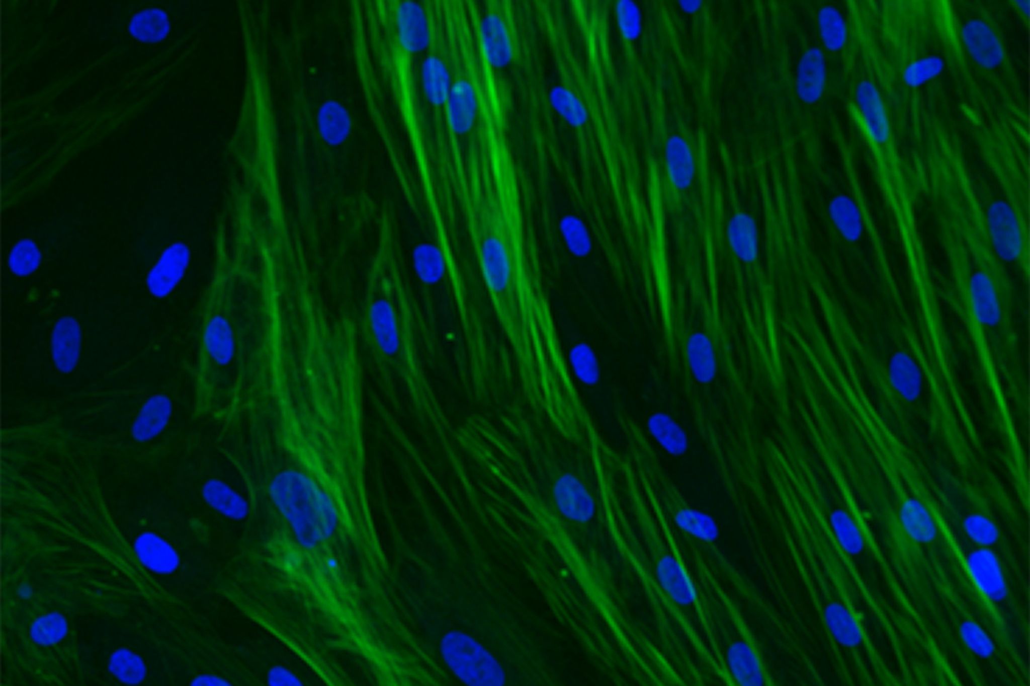 High content imaging of an in vitro fibrosis assay in myofibroblasts to study EMT, FMT M1 macrophage and M2 Macrophage transdifferentiation