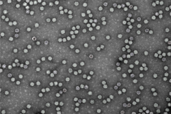 SA-Electron-microscopy-2.png