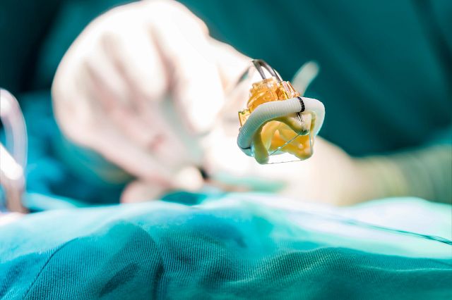 Close up view on artificial heart prosthesis
