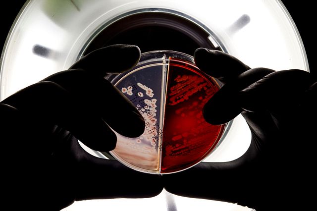 质量控制微生物实验室技术人员手持用于菌株分型测定的微生物样本板