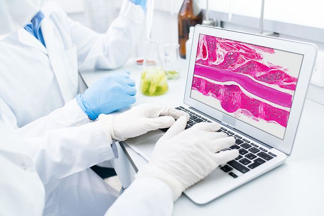 scientist in PPE typing on laptop, with screen showing ditial pathology image