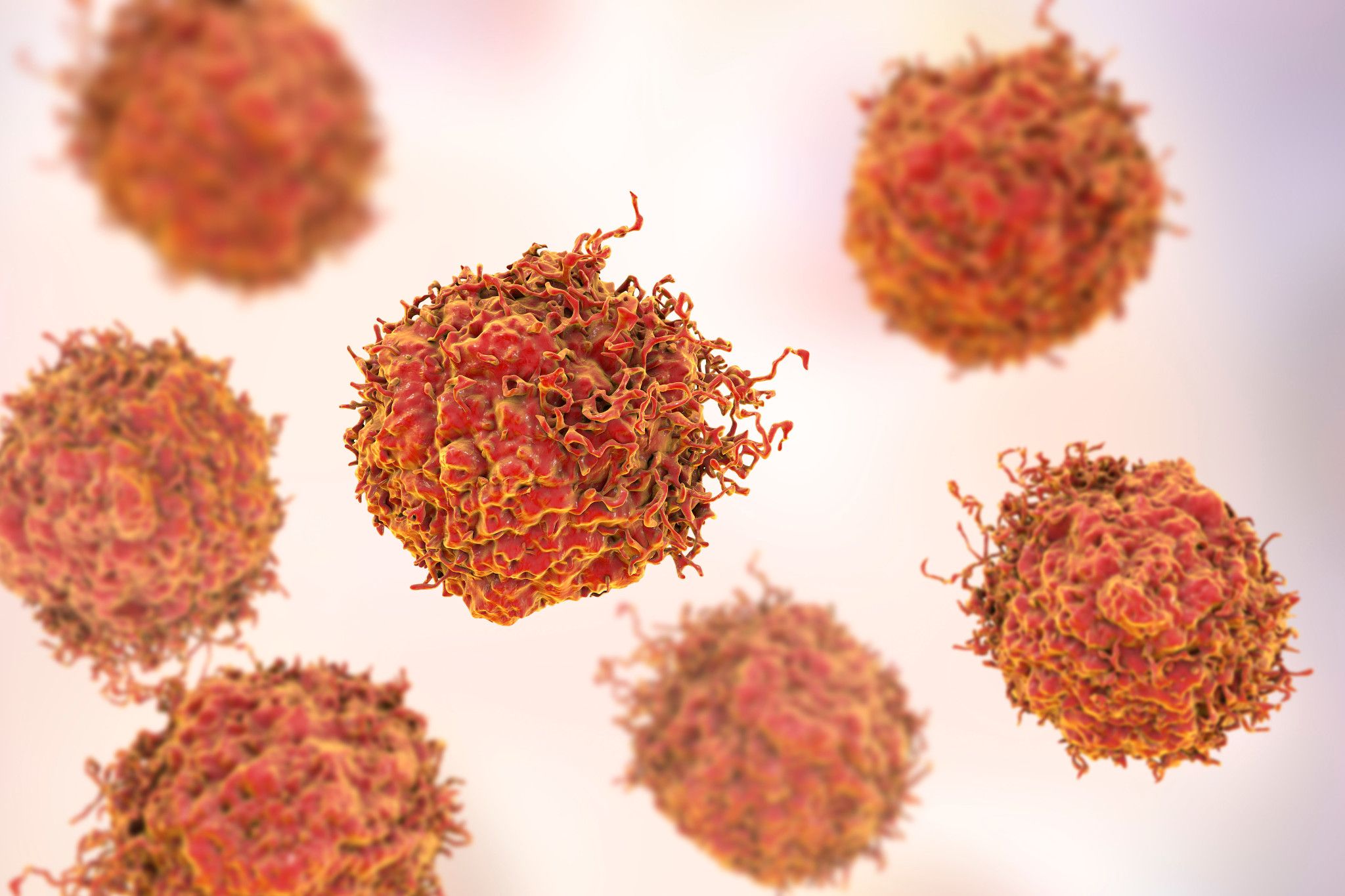 Cancer cells.