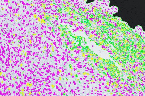 CD68 stain for macrophages within a mouse tumor