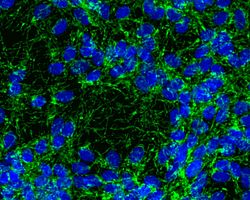 A high content image of dopaminergic neurons stained with BIII-Tubulin and dapi.