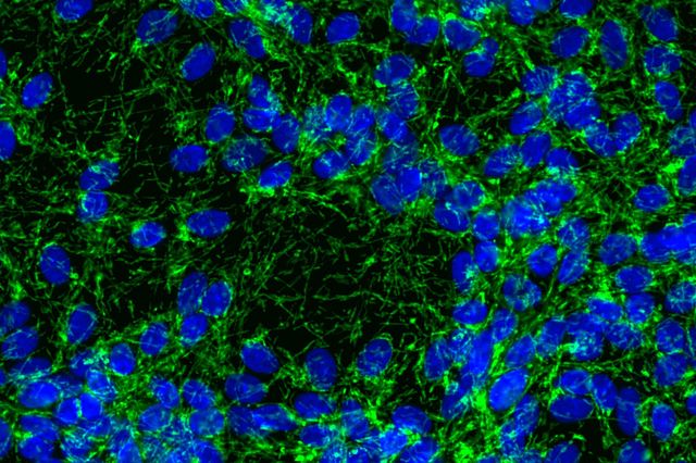 High content imaging to evaluate Tom20 immunoreactivity co-localized with MitoTracker dye in Parkinson’s disease relevant cells.