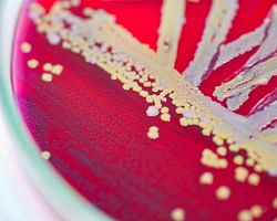 Petri dish