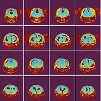 Preclinical Imaging: A Translational Approach to Assess New Cancer Treatments