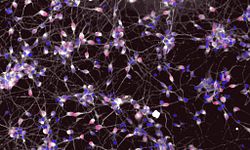 Preclinical application of iPSCs represents great promise in drug development.