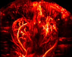 A functional ultrasound image of the brain illustrates one of many preclinical imaging capabilities for neurological diseases.