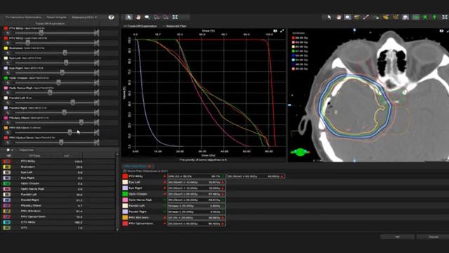 Eclipse treatment planning system