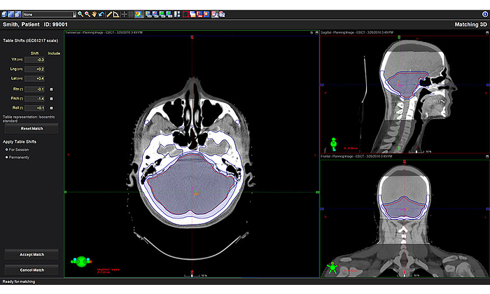 CBCT_07132016.png