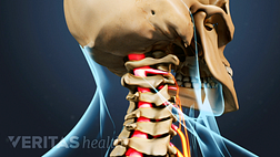 Posterior view of the neck showing the cervical spinal cord.