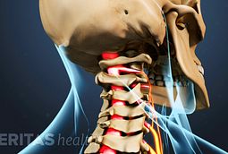 Neck Cracking And Grinding: What Does It Mean?